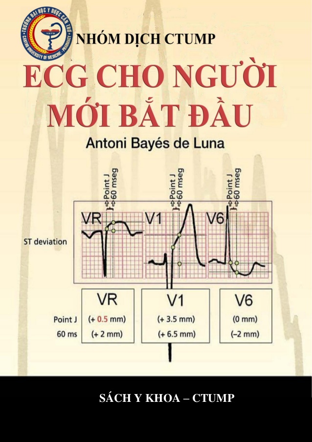 Điện Tâm Đồ Cho Người Mới Bắt Đầu – Ecgs For Beginners